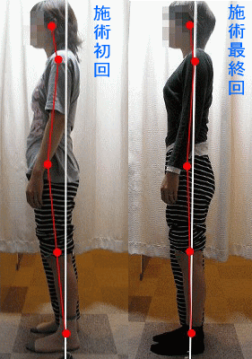 骨盤・姿勢矯正