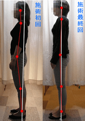 骨盤・姿勢矯正