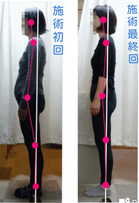 産後の骨盤・姿勢矯正