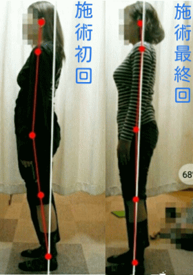 骨盤・姿勢矯正