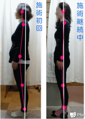 産後の骨盤・姿勢矯正