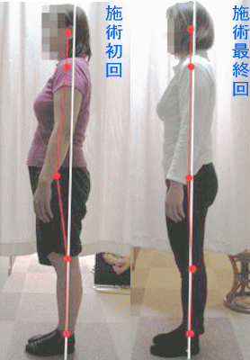 骨盤・姿勢矯正