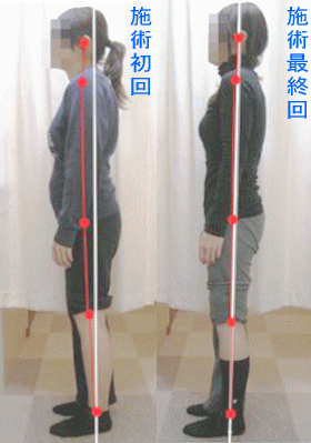 骨盤・姿勢矯正