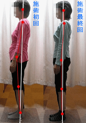 骨盤・姿勢矯正